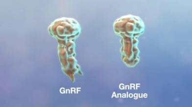 Fig 4 GnRF & analogue